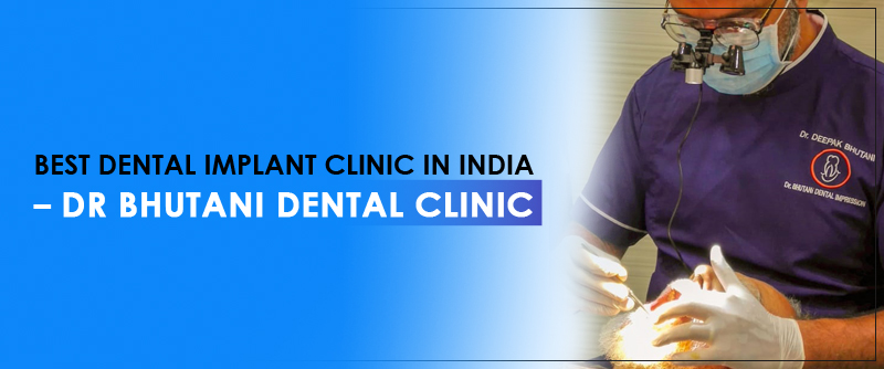 Best Dental Implant Clinic in India