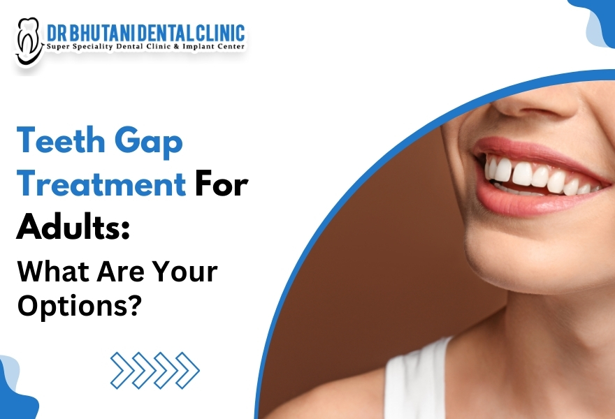 Teeth gap treatment