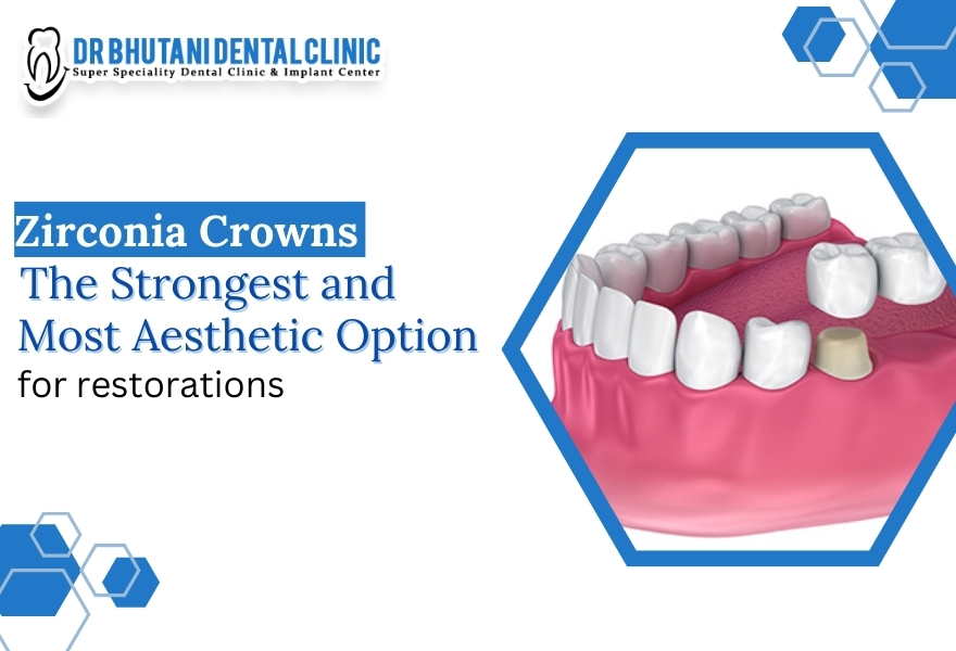 zirconia crowns