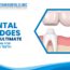 Dental Bridges