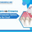 Ceramic Crowns Price In India