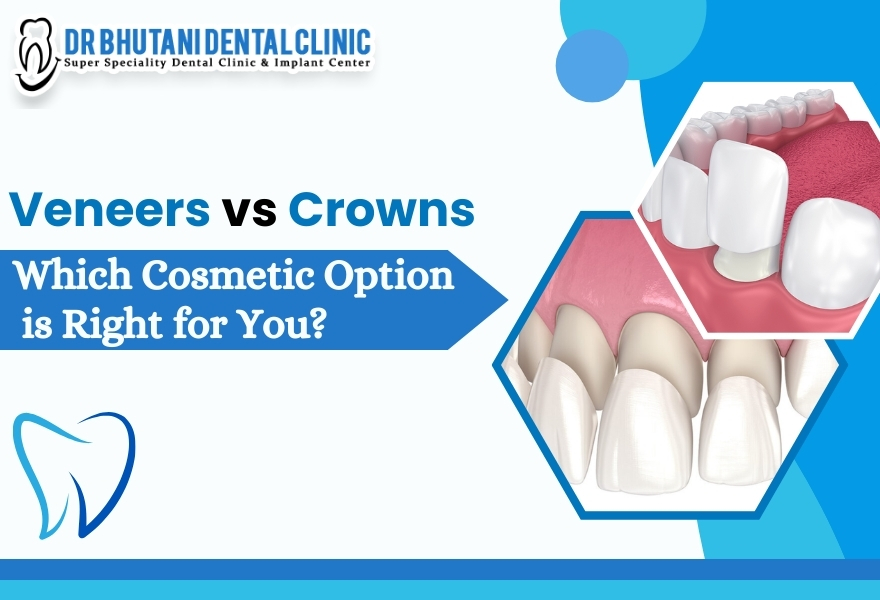 Ceramic Crowns Price In India