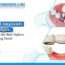 Dental Implants In Delhi