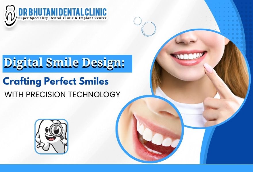 Smile Designing Treatment